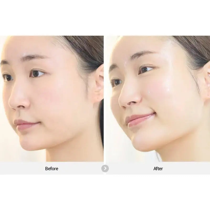 Rejuran - Healer Turnover Ampoule Dual Effect - Special Set - Rejuran - Ampoules - Harumio