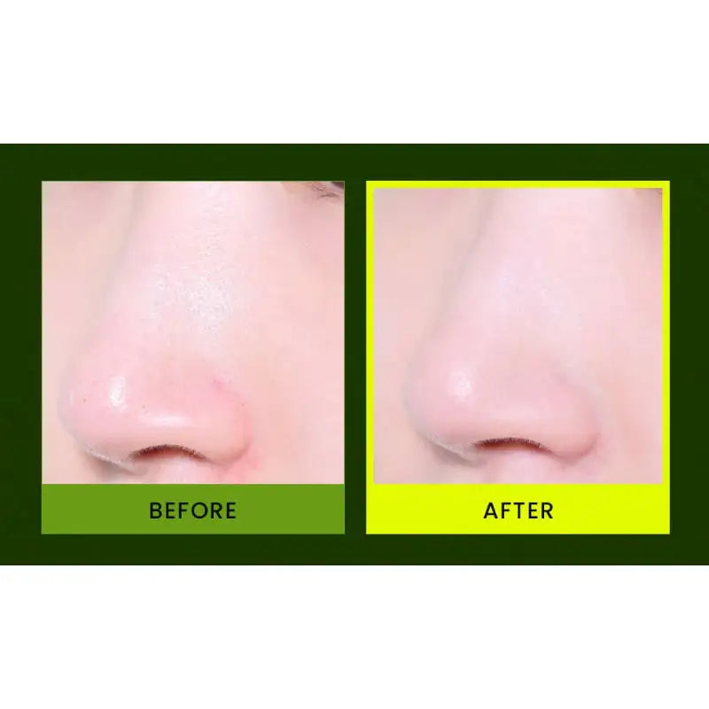 Olive Young - Beplain Mung Bean Pore Clay Pack 120ml - Olive Young - Skin Care Masks & Peels - Harumio